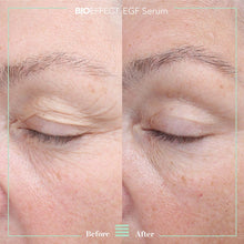 Charger l'image dans la galerie, SÉRUM EGF
