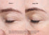Comparaison du contour des yeux aux jours 1 et 90 d’une étude clinique VISIA sur la Power Cream EGF BIOEFFECT.