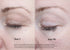 Comparaison du contour des yeux aux jours 1 et 90 d’une étude clinique VISIA après application du Sérum EGF.
